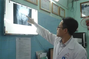 Chân bỗng ngắn đi 2cm do trật khớp háng lâu năm