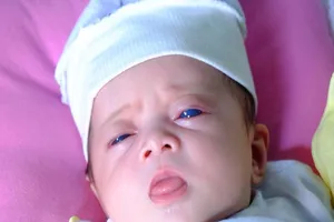 'Thiên thần mắt xanh' kỳ lạ chào đời ở Đồng Nai