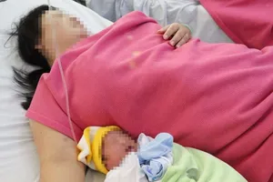 Cứu sống sản phụ bị nhau cài răng lược