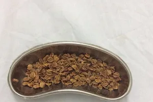 Nhiều hạt sơ ri nảy mầm trong hậu môn cậu bé 11 tuổi