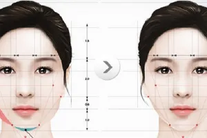 Tai biến nguy kịch sau khi đi gọt hàm