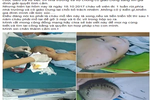 Bé 3 tuổi bị chấn thương sọ não ở trường mầm non