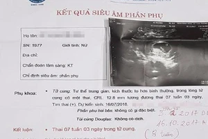 Triệt sản vẫn bầu đứa thứ 4, thai phụ bức xúc