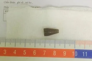 Tai nạn bất ngờ với đầu bút bi 