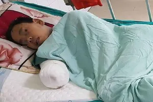 Trèo tường bị điện giật bất tỉnh, phải cắt cụt cánh tay