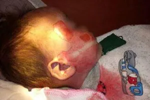 Nghi vấn bé 15 tháng tử vong với nhiều vết thương “lạ“