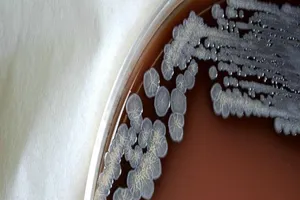 Căn bệnh bị lãng quên khiến bệnh nhân suýt bị đưa về lo hậu sự