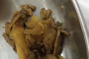 Hi hữu: Suýt hoại tử ruột sau khi ăn quá nhiều măng khô