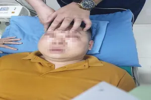 Nam thanh niên sốc phản vệ nặng sau khi thái một củ hành