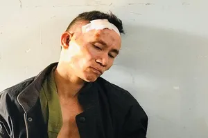 Giám định tâm thần người đấu súng với công an trước cổng trụ sở