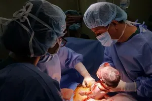 Cứu sống ngoạn mục bé sơ sinh bị lồi ruột gan ra ngoài 