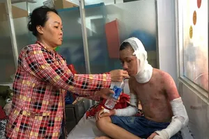 Hai học sinh bị bỏng cồn nặng khi đang học thí nghiệm 