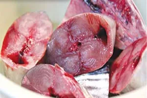 Cô gái tổn thương phổi nặng, suýt chết sau khi ăn cá ngừ