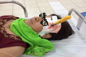 Bị dao đâm xuyên não 6 cm vì trượt chân té khi cạo vôi 