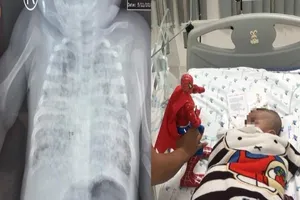 Bé 2 tháng tuổi phổi trắng xóa vì nhiễm lao từ cha 
