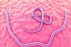 Những dấu hiệu nhận biết cơ thể bị nhiễm ký sinh trùng