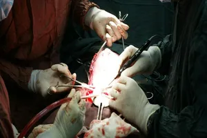 Mẹ ngưng tim khi mổ bắt 2 bé song sinh thụ tinh ống nghiệm