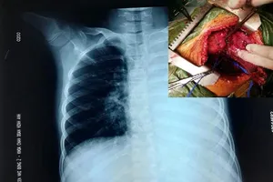 Ca mổ 10 bác sĩ gặp phải hết 8 người muốn bỏ cuộc