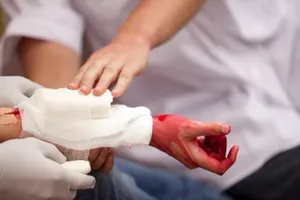 Đừng để mất mạng vì không biết cách sơ cứu cầm máu