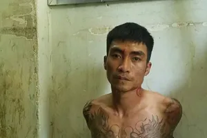 Nữ hộ sinh bị đánh vỡ hốc mắt, xương mũi trong thang máy