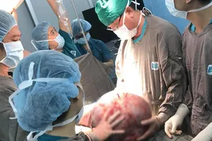 'Giải cứu' người phụ nữ mang khối u khổng lồ nặng 25 kg