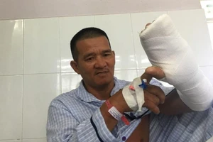 'Hiệp sĩ' Bình Dương bị thanh niên ngáo đá chém đứt gân tay