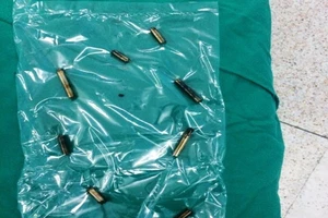 Nuốt tám thanh nam châm, bé bốn tuổi thủng ruột nhiều nơi