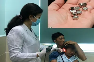 Nhét pin điện tử vào tai, bé trai năm tuổi thủng màng nhĩ