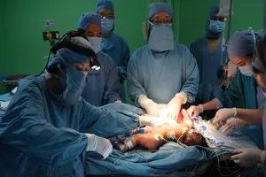 18 bác sĩ tách thành công cặp song sinh dính liền phần gan
