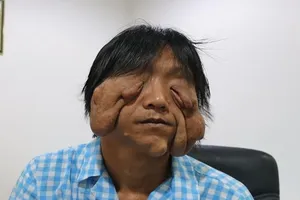 U 'quái' làm chàng trai khổ sở suốt 17 năm ròng 