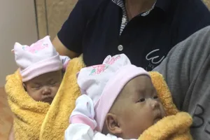 Ngắm vẻ đáng yêu của hai bé sinh đôi dính nhau khi xuất viện