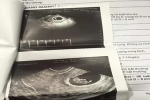 Thanh tra Sở Y tế vào cuộc vụ hút mỡ bụng cho phụ nữ có thai