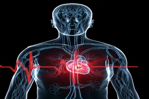 Hẹp van động mạch chủ: Kẻ giết người thầm lặng