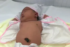 Bé gái cân nặng 5,2 kg chào đời an toàn