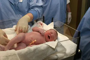 Sinh con tại nhà: 10/100 bé sơ sinh chào đời không tự thở được