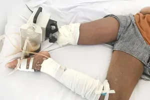 Nguy cơ đoạn 2 chân vì rắn cắn 1 chân, đi hút máu độc 2 chân