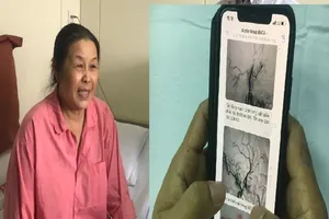Bác sĩ trao đổi qua viber cấp cứu thần tốc bệnh nhân đột quỵ