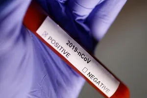 Người nghi ngờ nhiễm virus Corona, nên khám ở đâu? 