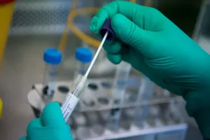 Không cho phép xét nghiệm COVID-19 theo yêu cầu