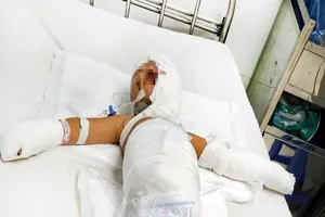 Bé trai bị bỏng nặng sau vụ ném bom xăng trả thù của người lớn