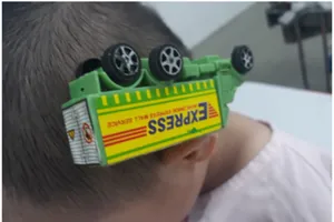 Cấp cứu cho bé trai bị xe đồ chơi cắm vào đầu