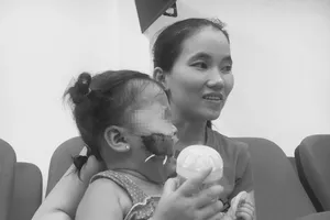 Bé trai bị chó cắn thương tích nặng khi đang ăn xúc xích