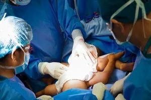 2 bé song sinh được tách rời hoàn toàn, chảy máu lượng ít