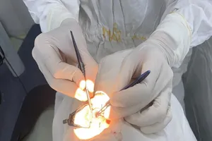 TP.HCM: Bác sĩ đến nhà nhận hai giác mạc của người hiến tặng