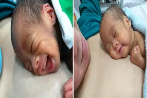 Sức sống mãnh liệt của bé gái sinh ra chỉ nặng 700gr