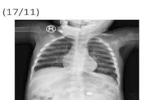 Chữa rối loạn tiêu hóa cho bé trai, phát hiện sự thật bất ngờ