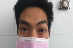 21 tuổi đi khám mắt không ngờ phát hiện bệnh cực nguy hiểm