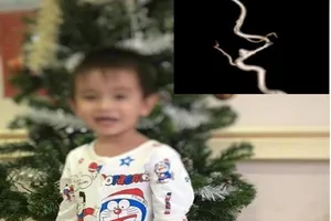 Bé trai 3 tuổi đột quỵ vì nguyên nhân không ngờ 