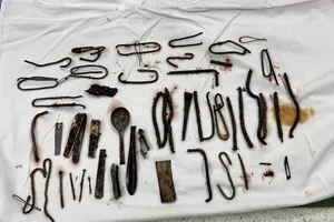 Có dấu hiệu trầm cảm, người đàn ông ăn tá lả kim loại