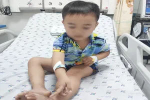 Cậu bé 4 tuổi bị rắn cắn khi đang thả diều